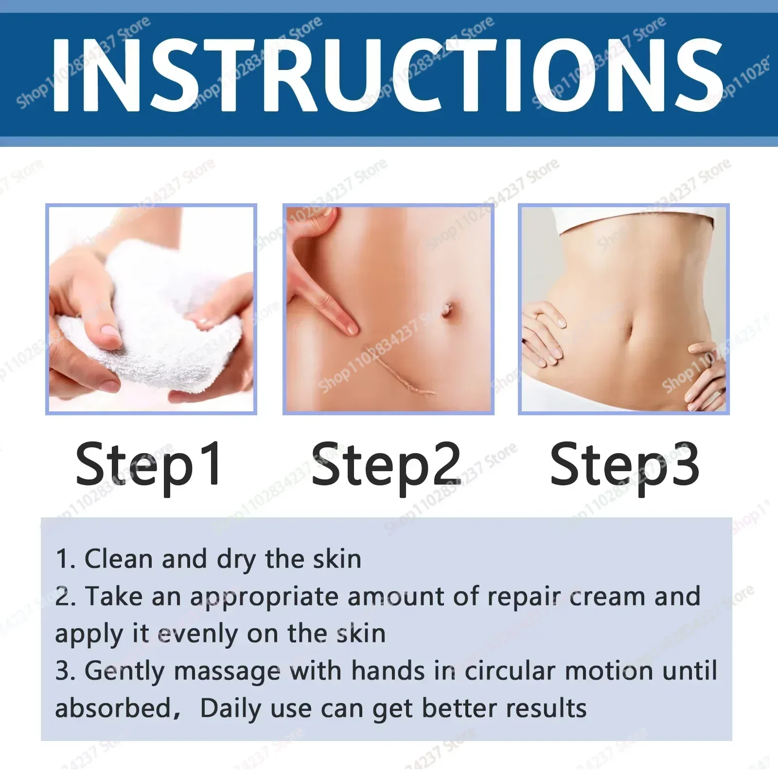HOT SALE Removes Stretch Mark To Remove Postpartum Obesity Pregnant Women Repair Anti-Aging Winkles Firming Body Skin Care