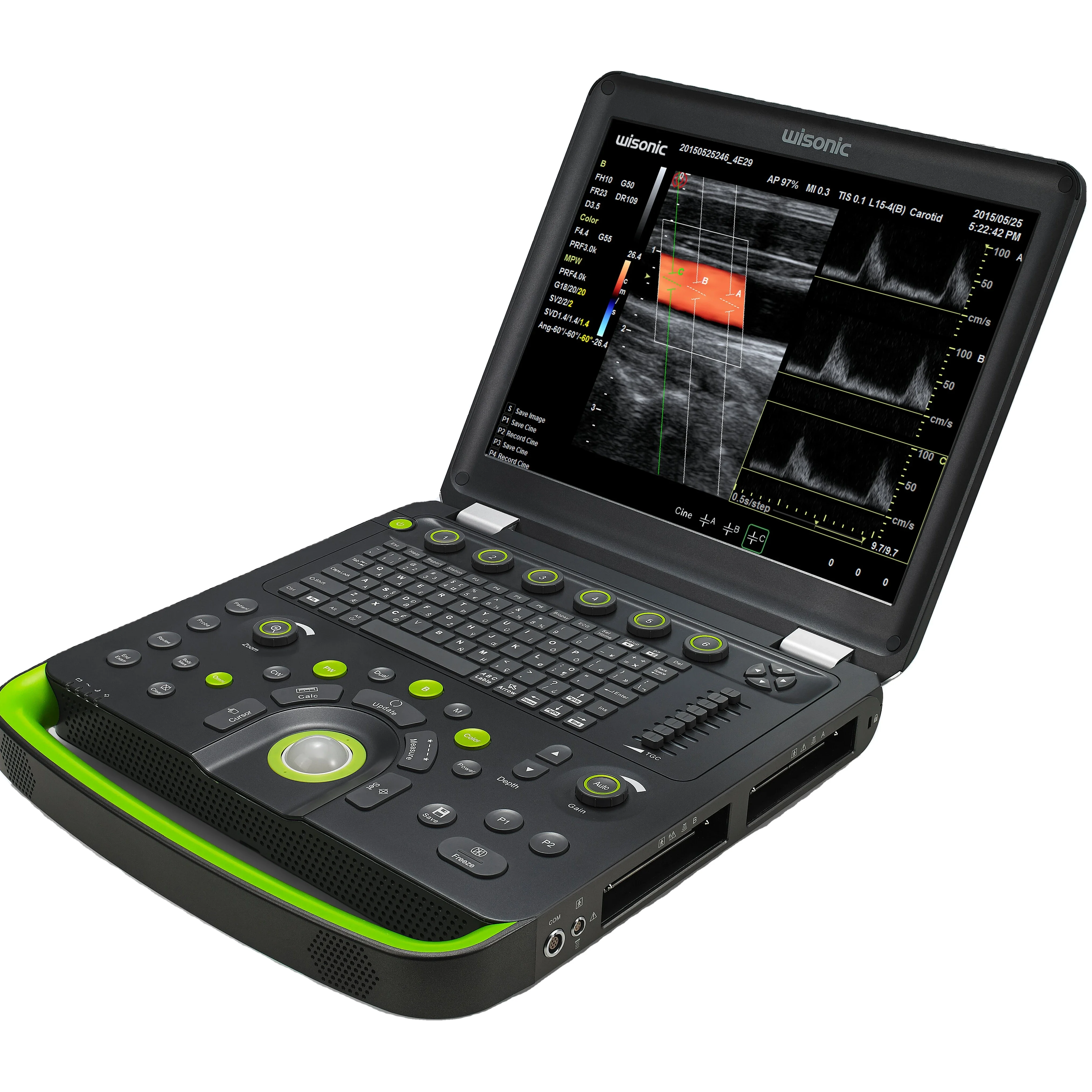 15-дюймовый экран портативный ноутбук