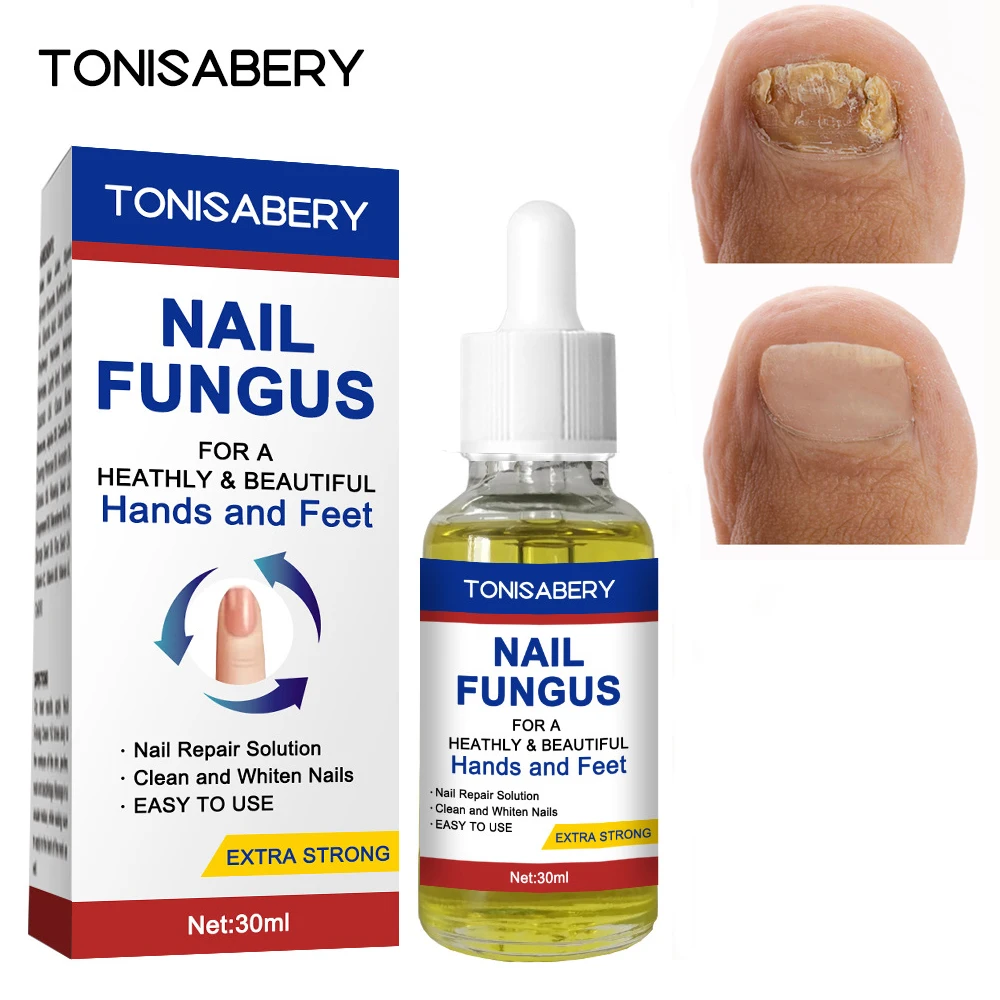 

Nail Fungal Treatment Feet Care Essence Against Fungal Nail Oils Nail Fungus Removal Gel Anti Infection Paronychia Onychomycosis
