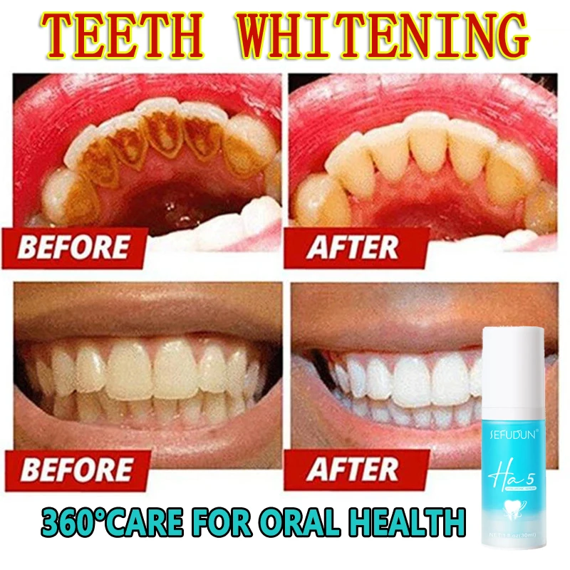 

Restorative Function Toothpaste Repair and Improve Teeth Sensitivity Tooth Correction Whitener Whitening Toothpaste