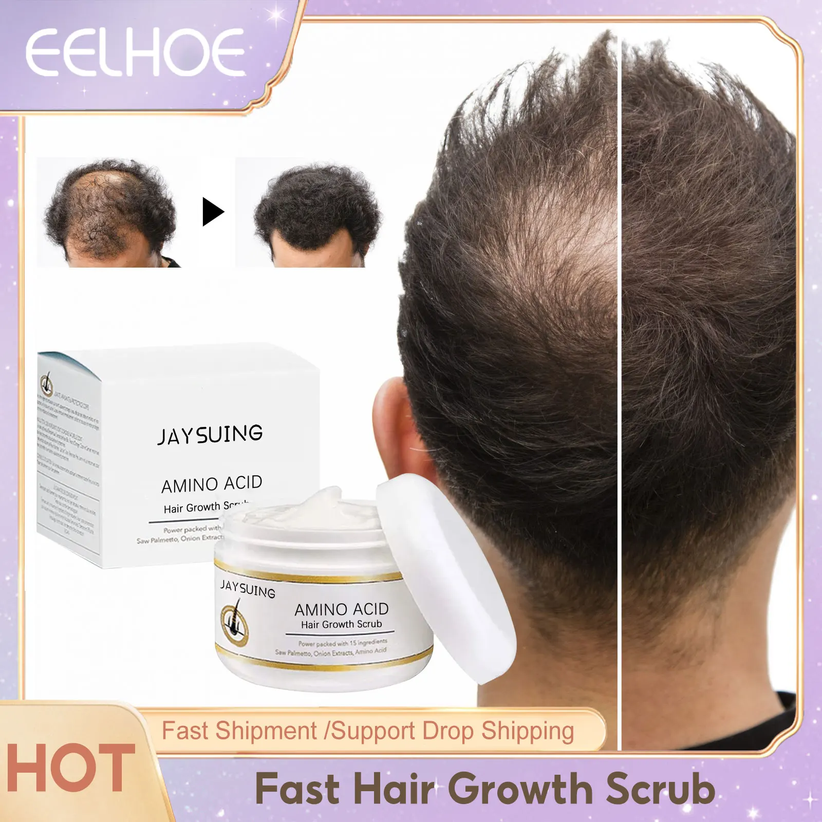 

Hair Growth Scrub Anti Hair Loss Nourishing Dry Damaged Baldness Treatment Scalp Deep Cleansing Strengthen Hair Root Care Scrub