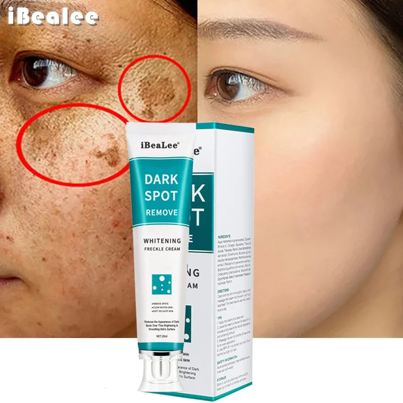 Effective Whitening Freckles Cream Remover Melanin Melasma Brighten Fade Dark Spots Acne Scars Anti-Aging Moisturizing Skin Care