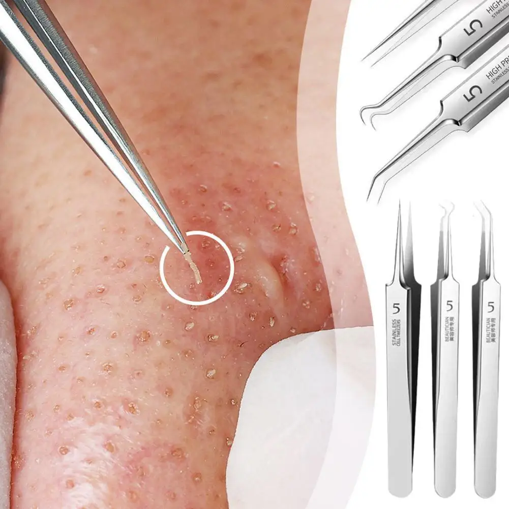 

Ultra-fine Professional No. 5 Acne Blackhead Removal Face Salon Cleaner Clip Needles Skin Tweezers Pimples Tool Beauty Care Z5Q1