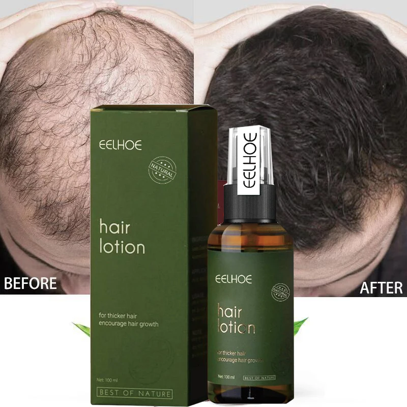 

Спрей для роста волос с эссенцией, 00 мл