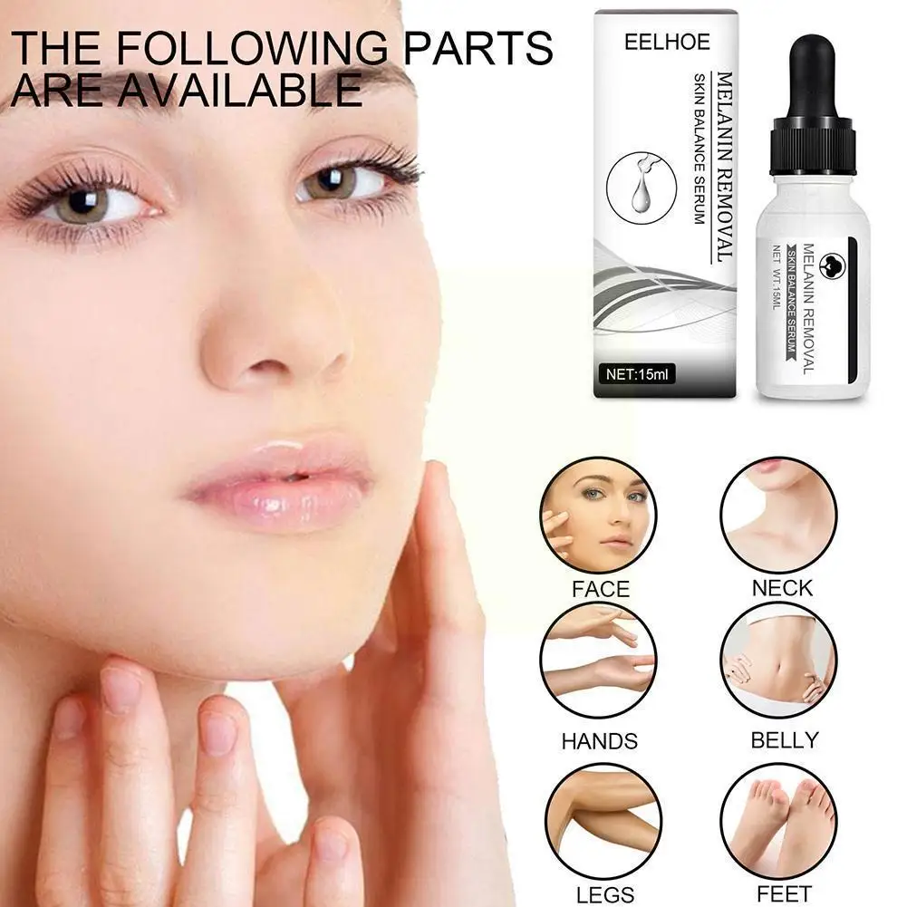 

15ml Whitening Freckle Face Serum Remove Melasma Essence Melanin Fade Skin Dark Brighten Skin Pigment Correction Care Spots R4P3