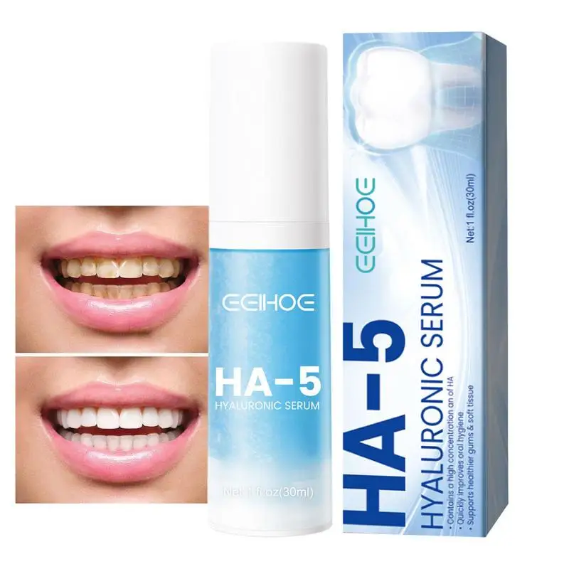 

30ml Gum Foam Toothpaste Whitening Mousse Bright White Teeth Deep Refreshing Stain Ultra-fine Removal Gums Breath Cleaning