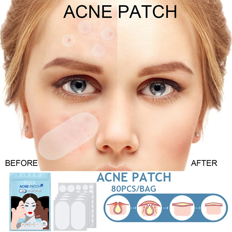 

80PCS Acne Patch Invisible Acne Removal Pimple Treatments Anti-Infection Pimple Absorbing Skin Care Makeup Tool