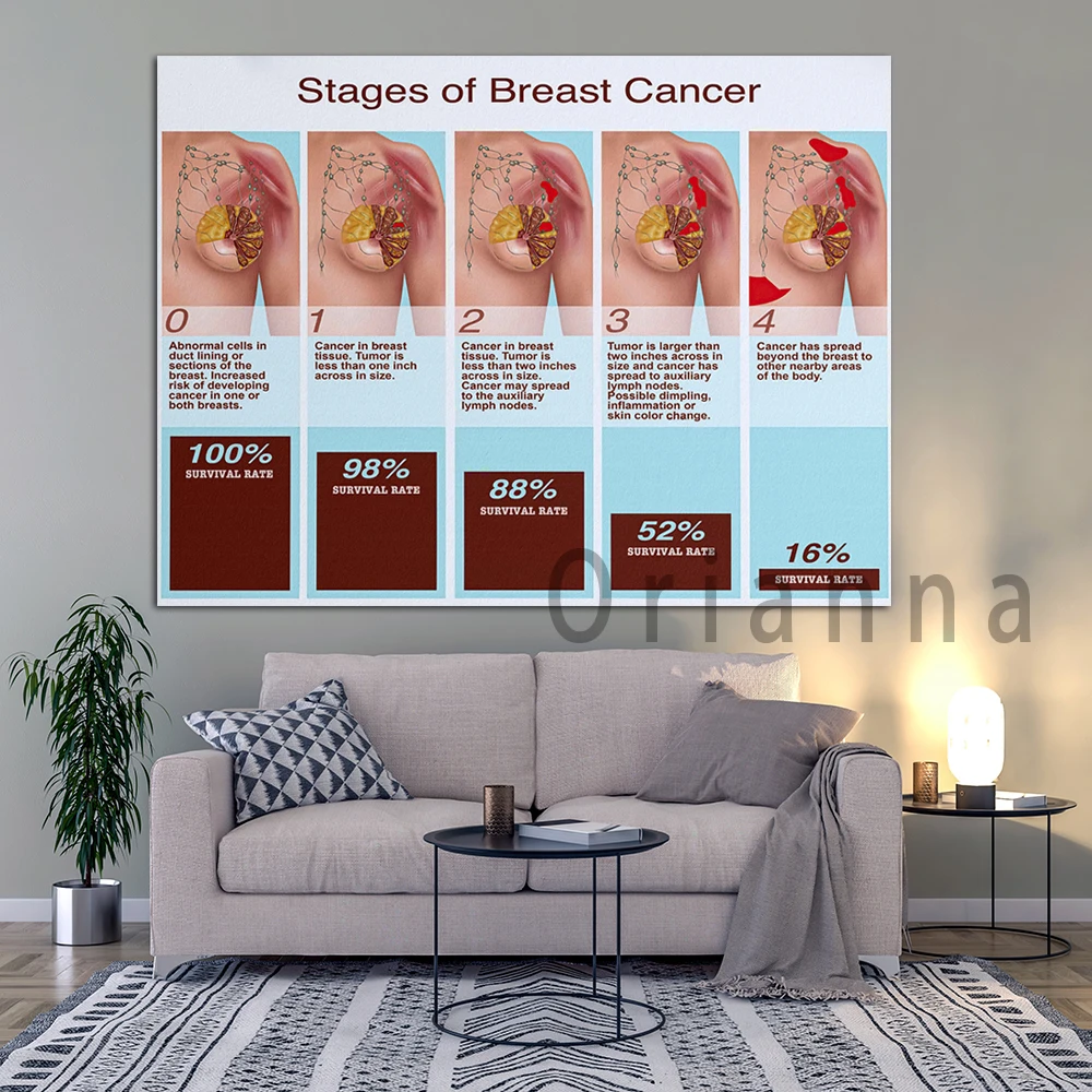 Домашний декор печать стадий рака молочной железы горизонтальная Картина на