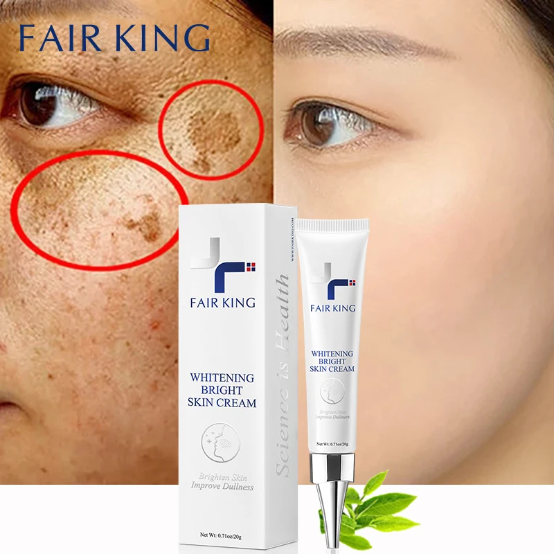 

Powerful Whitening Freckle Face Cream Remove Dark Spots Fade Melasma Acne Scars Lighten Melanin Anti-Aging Brighten Skin Care