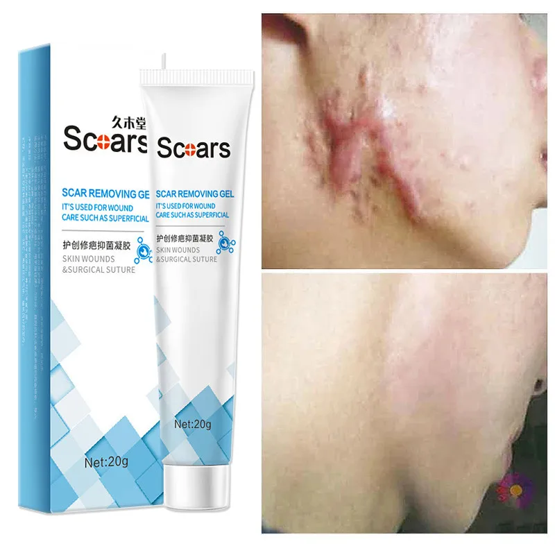 

Acne Scar Removal Cream Repair Burn Surgical Scars Gel Stretch Marks Acne Spots Treatment Stretch Skin Smoothing Care Ointment