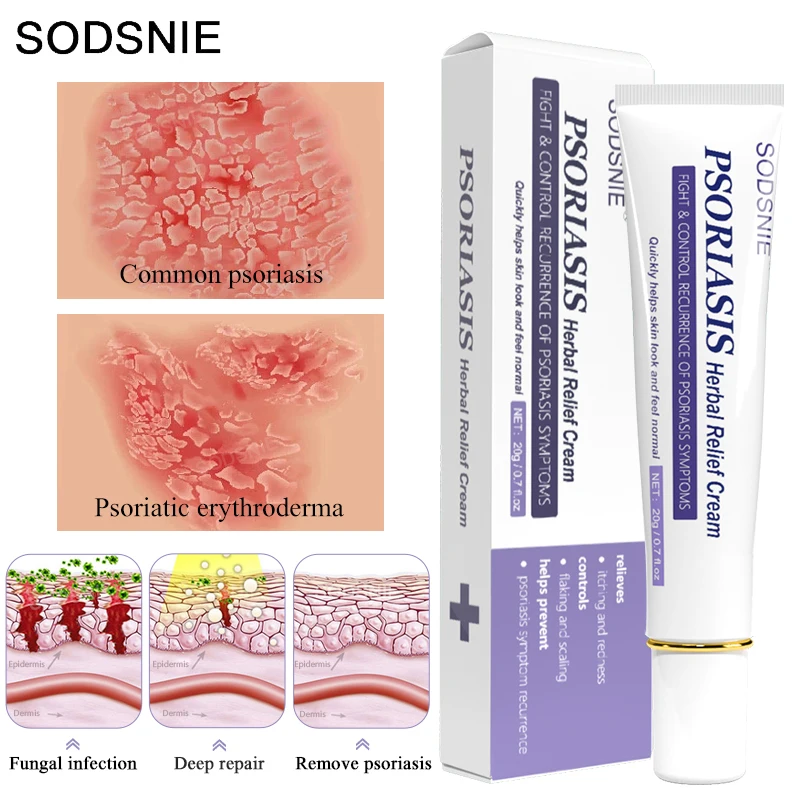 

Крем от псориаза травяной, противовоспалительный, стерилизующий и устраняющий зуд, глубокое питание, мощный Восстанавливающий уход за коже...