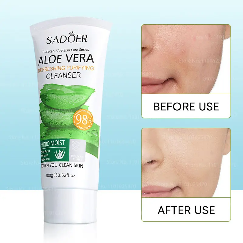 

Aloe Facial Foam Cleanser Gel Soothing Moisture Deep Pore Cleansing Remove Blackheads Whitening Face Wash Skin Care 100g