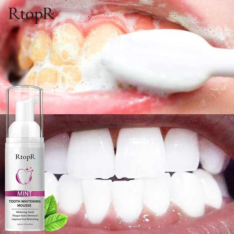 

RtopR Teeth Whitening Mousse Toothpaste Deep Cleansing Removes Stains Dental Bleaching Breath Fresh Oral Hygiene Products 60ml