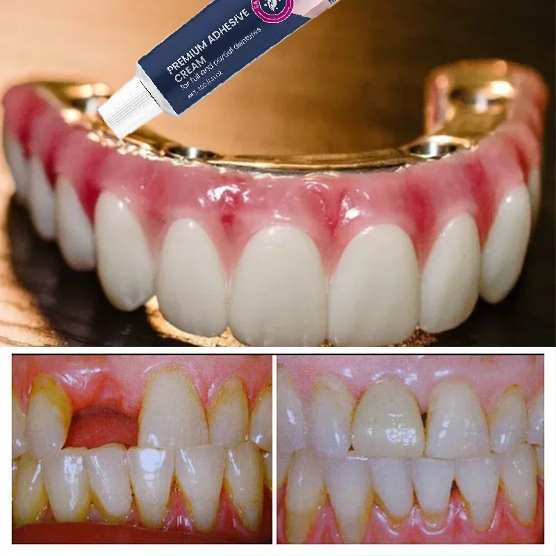 Клей для фиксации зубных протезов улучшает комфорт износа предотвращает