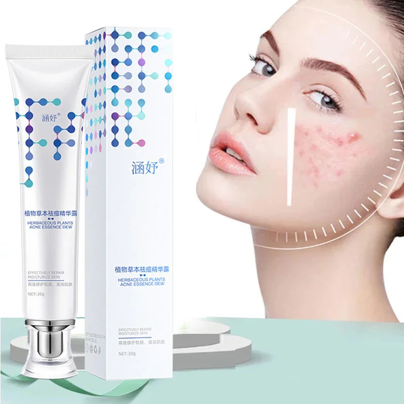 

Herbal Acne Removal Face Cream Gel Salicylic Acid Anti-Acne Treatment Shrink Pores Acne Scar Repair Oil Control Skin Care 30g