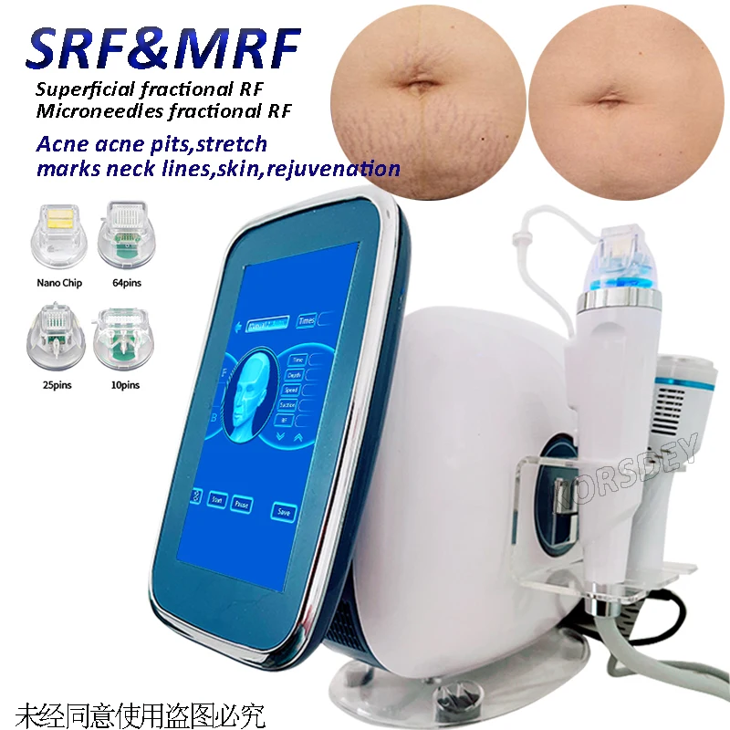 

Vacuum RF Microneedle Repair Acne/ Stretch Marks/Scars Shrink Pores Wrinkle Removal Skin Tightening Multifunctional Machine