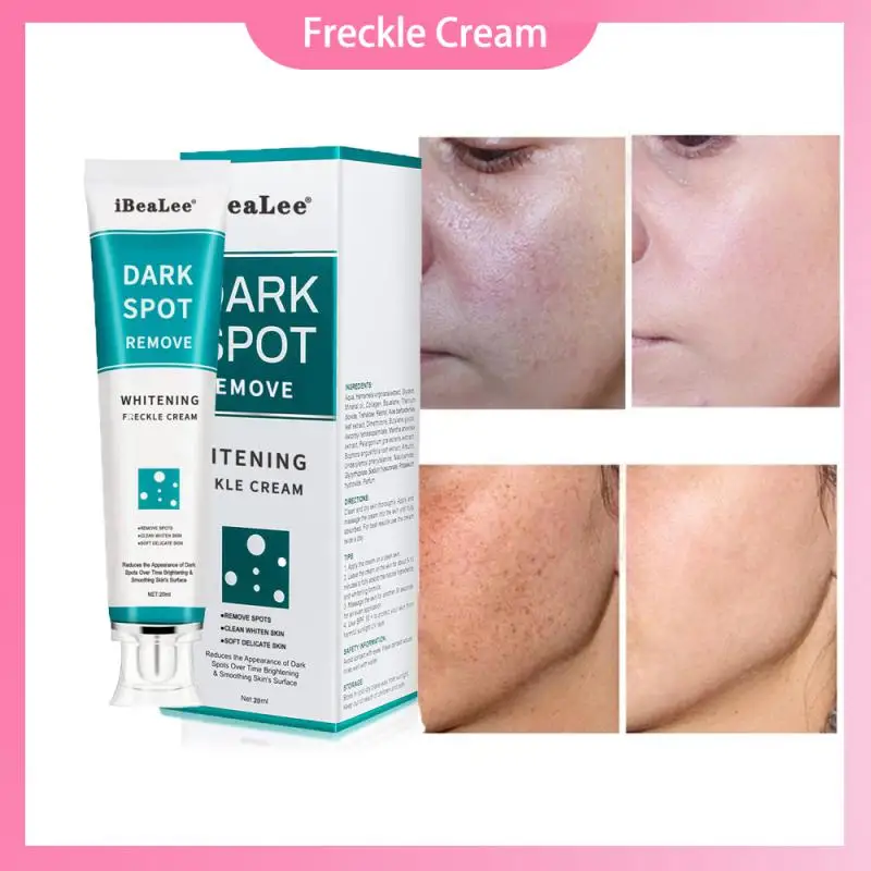

IBeaLee Whitening Freckle Cream Remove Dark Spots Remove Melasma Anti Freckle Cream Fade Pigmentation Anti-Aging Light Skin Care