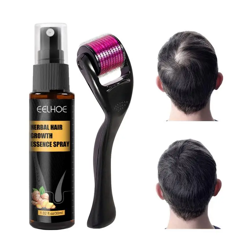 

Sdotter Hair Growth Spray Anti-Hair Loss Hair Essence Spray Herbal Hair Growth Essence For Men And Women Hair Care Beauty Produc