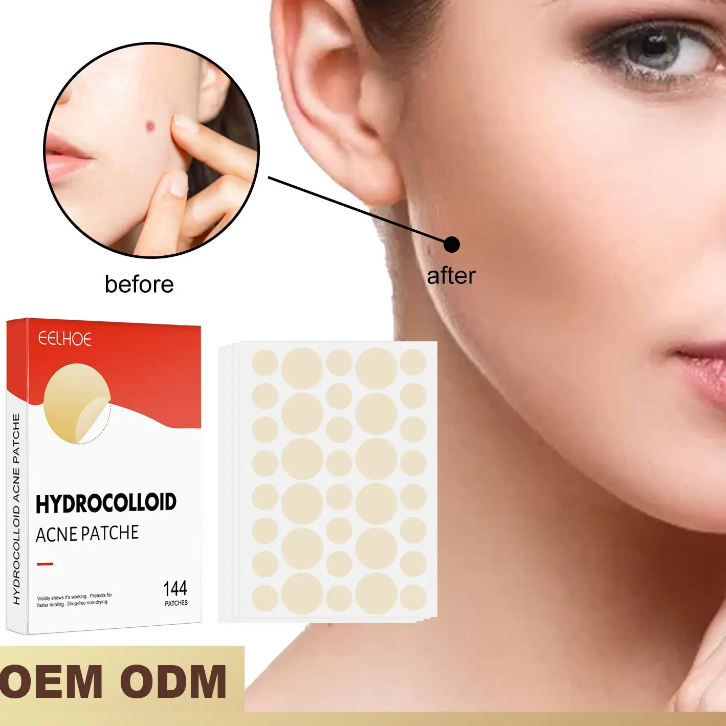 

Гидроколлоидная Бриллиантовая невидимая Накладка для макияжа, закрытое полотно рта, Водонепроницаемая дышащая Накладка для восстановления кожи от акне