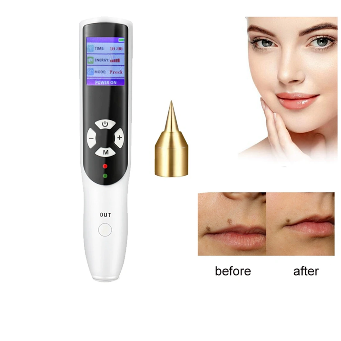 

2022 Latest Ozone Fibroblast Plasma Pen For Eyelid Face Lifting Wrinkle Spot Mole Freckle Removal Skin Care CE