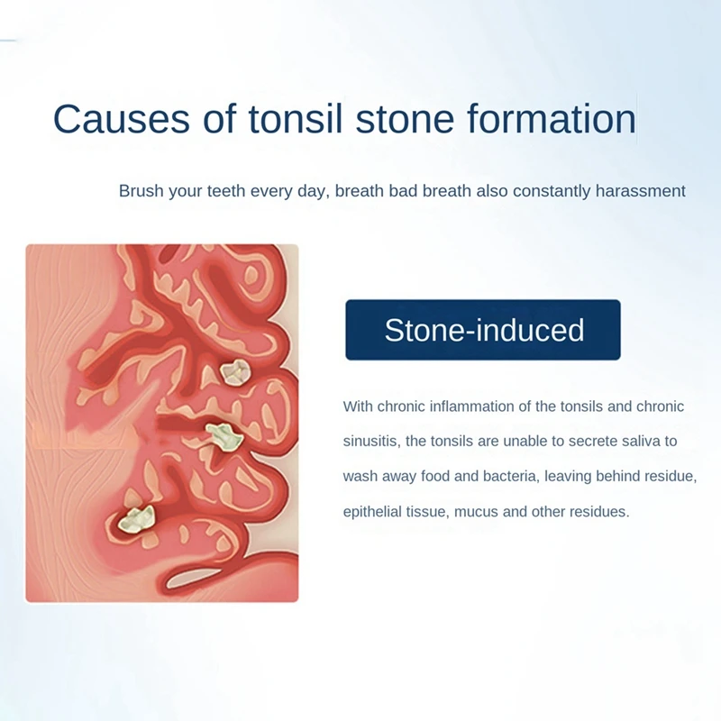Электронный вакуум для удаления камней из миндаля набор инструмент с миктєвым