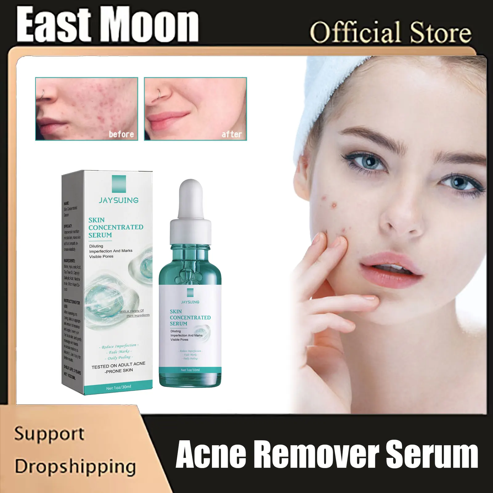 

Acne Treatment Serum Oil Control Fade Acne Mark Remove Pimple Scar Blackhead Moisturizing Soothing Repair Pore Shrinking Essence