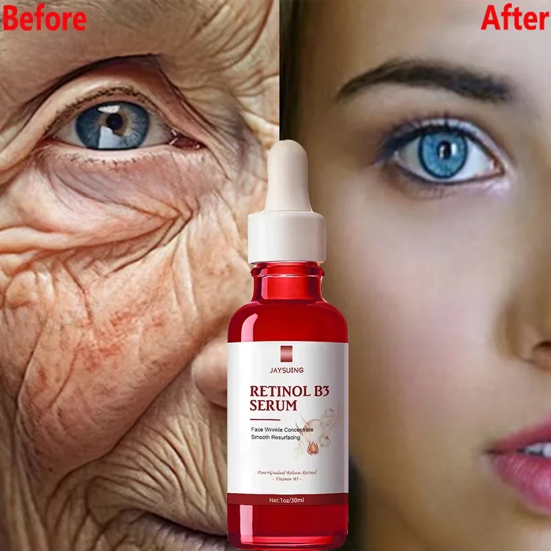 Сыворотка для лица с ретинолом удаления морщин мгновенный укрепляющий лифтинг
