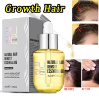 35ml hair growth serum smoothing prevent hair loss oil scalp treatments fast growing hair products for men women best products
