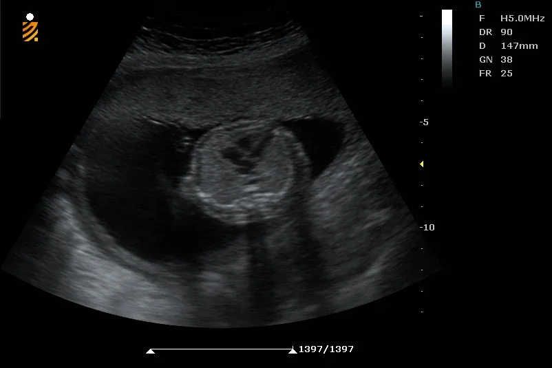 Рисунок 6 - Ветеринарное ультразвуковое устройство