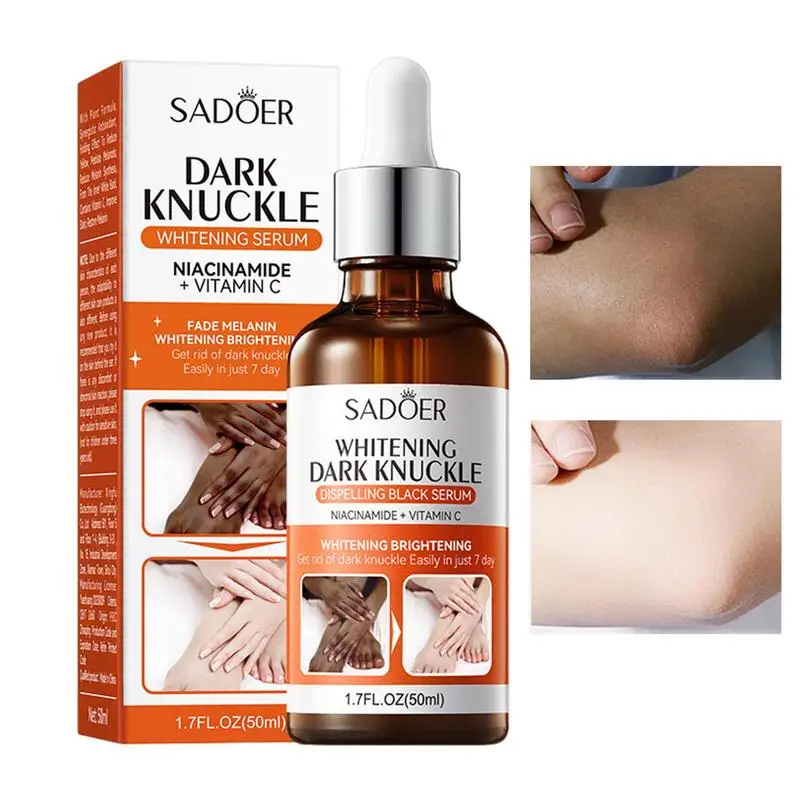 

Joint Melanin Removal Serum Dark Skin Lightening Moisturizer Dark Knuckle Whitening Essence Elbow Knee Bleaching Body Care Oil