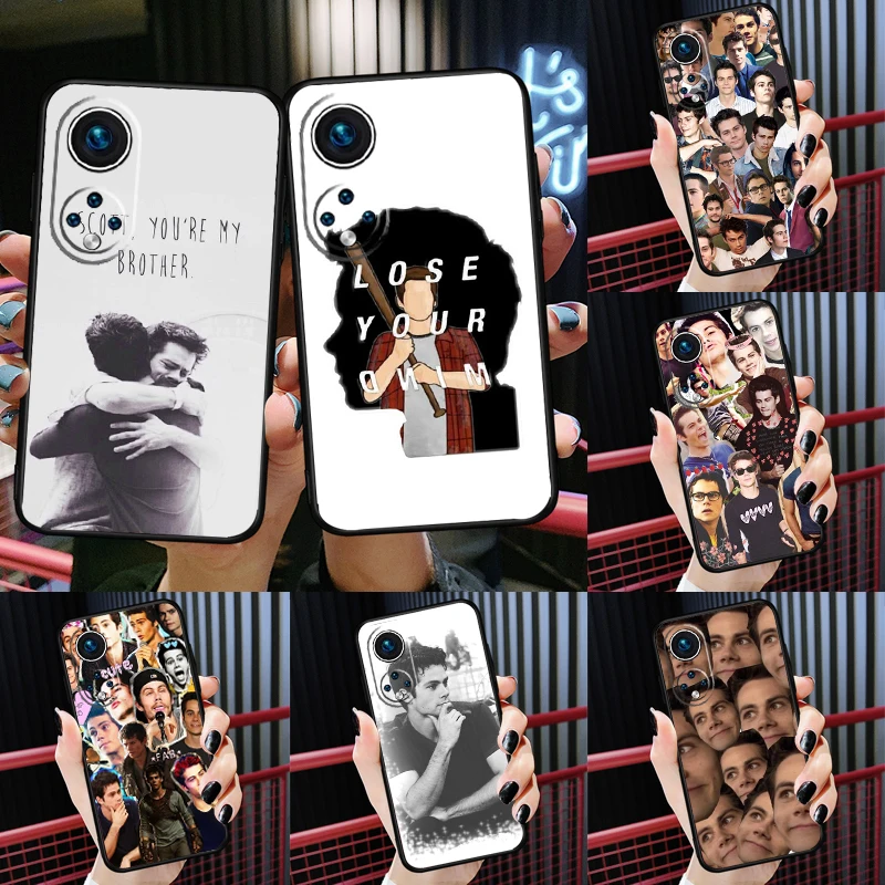 

Teen Wolf Dylan Obrien For Huawei P20 P30 P40 P50 Pro Lite P Smart Z 2019 Nova 9 Nova 5T Case For Honor 50 Cover