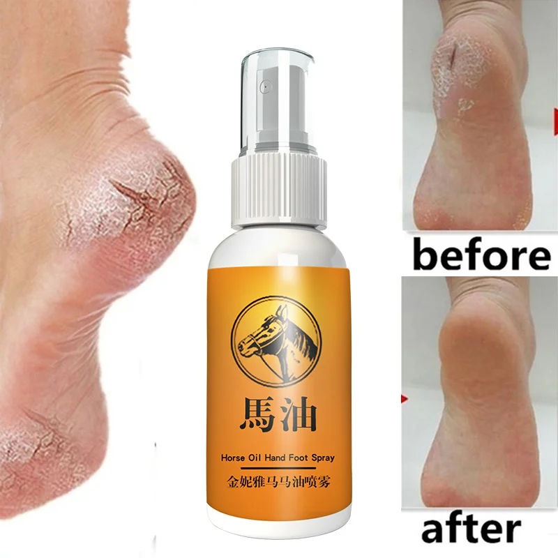 

Traditional horse oil spray beriberi anti drying repair heel crack repair remove dead skin hand and foot care spray