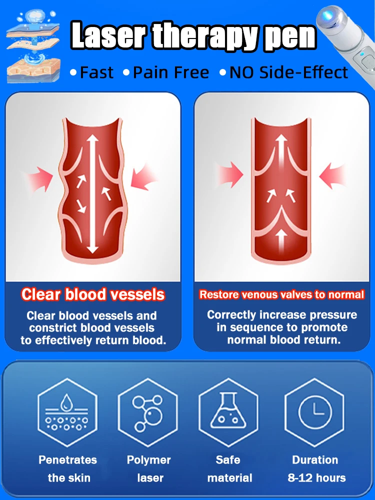 Крем-лазер Varicosse