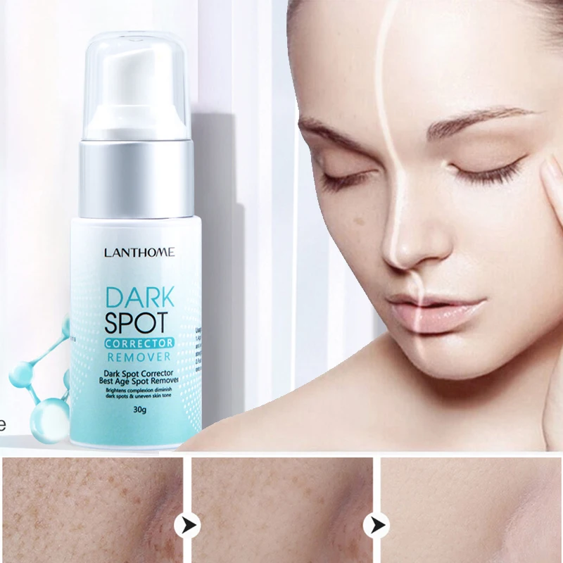 

30ml Whitening Freckle Cream Remove Melasma Dark Spots Lighten Brighten Skin Anti-Aging Face Cream Skin Care Moisturizers Creams