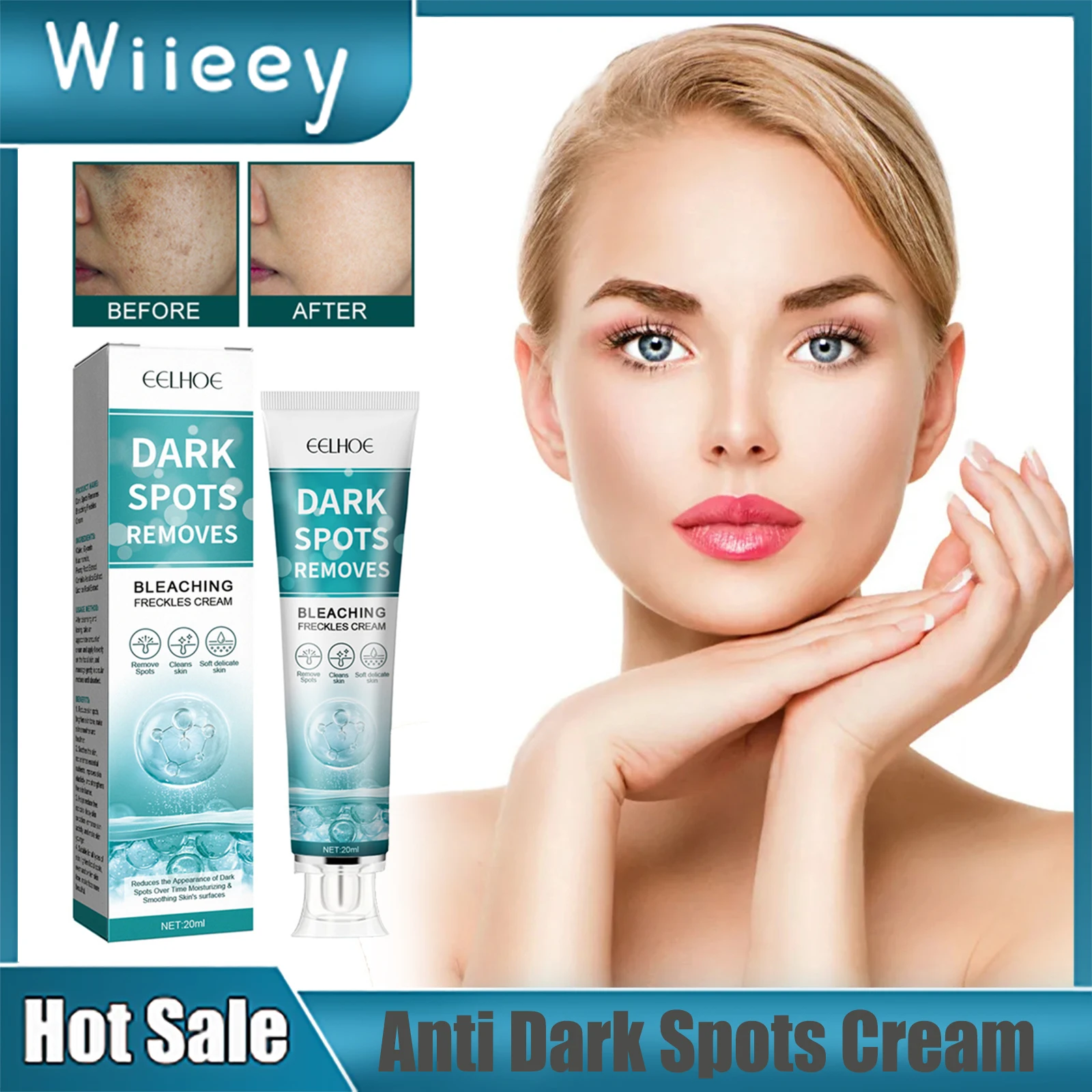 

Anti Dark Spots Cream Remove Melanin Fade Pigmentation Lightening Melasma Moisturizing Brighen Bleaching Whitening Freckle Cream