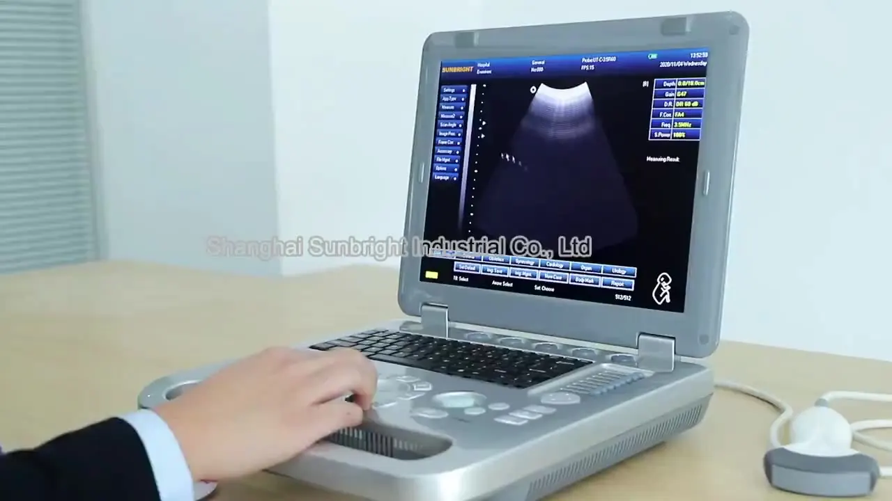 

portable 3d ultrasound Portable color ultrasound machine price SUN-800D