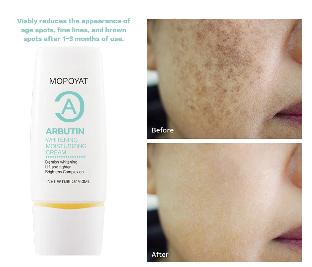 

Arbutin Whitening Cream, Brightening Moisturizing Serum, Reduce Dark Spots, Acne Scars Facial Skin Care