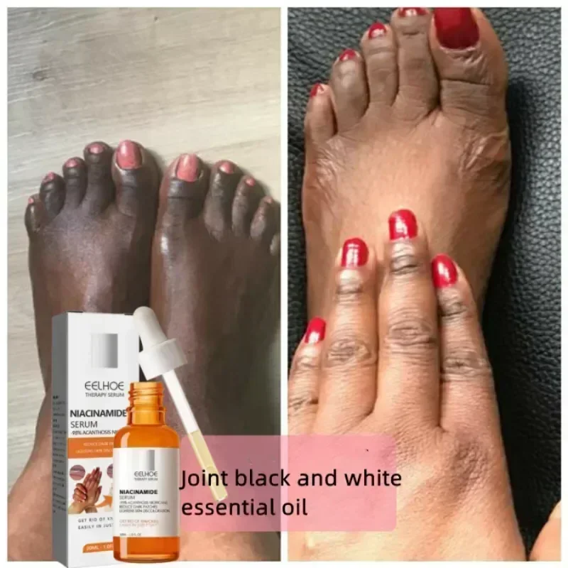 Омолаживающая сыворотка для локтей темных коленей удаление кожи частными