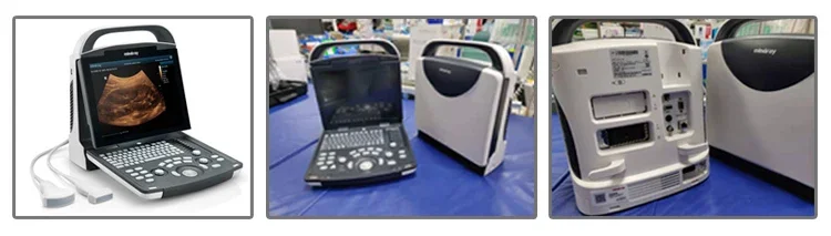 Ультразвуковой ультразвук Mindray dp 10 более дешевая цена медицинские