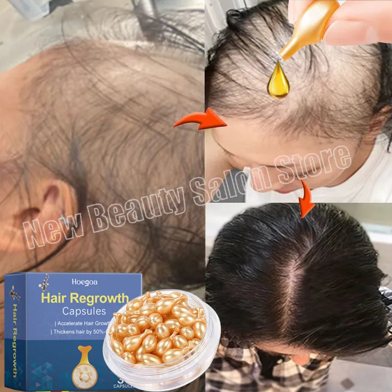 Сыворотка для роста волос 7 дней