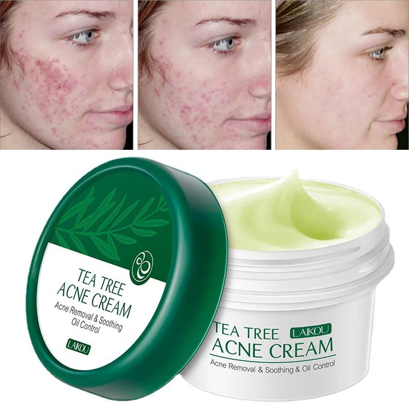 

Herbal Acne Removal Face Cream Effective Pore Shrink Gel Fade Facial Back Acne Mark Scar Tea Tree Oil Treatment Serum Skin Care