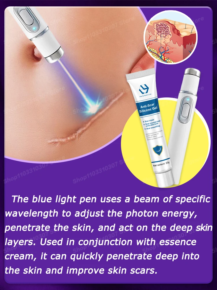 Ремонт шрамов для удаления Keloid