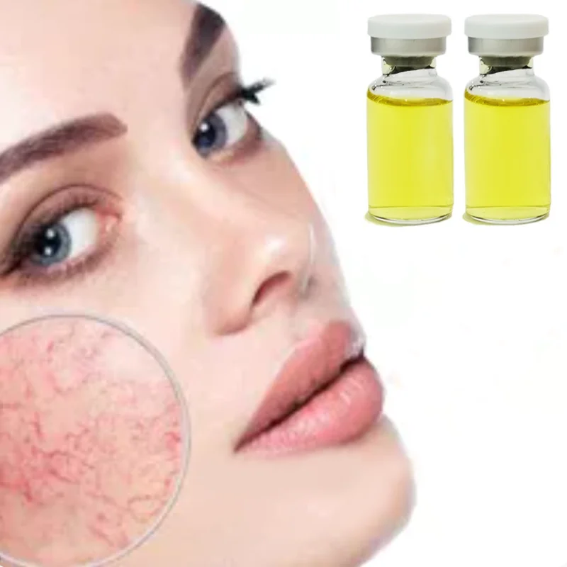 

Anti Redness Spider Vein Remover Facial Varicose Vein Essence Brightening Whitening Red Blood Anti-wrinkle Stem Ampoule Essence