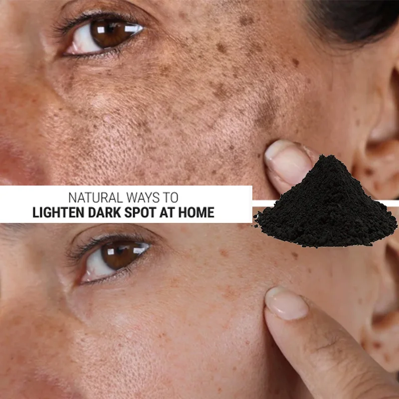 

South Africa Black Brick Remove Dark Spots Get Rid of Uneven Skintone Fade and Absorb Pigmentation Black Spots Freckles Melasma