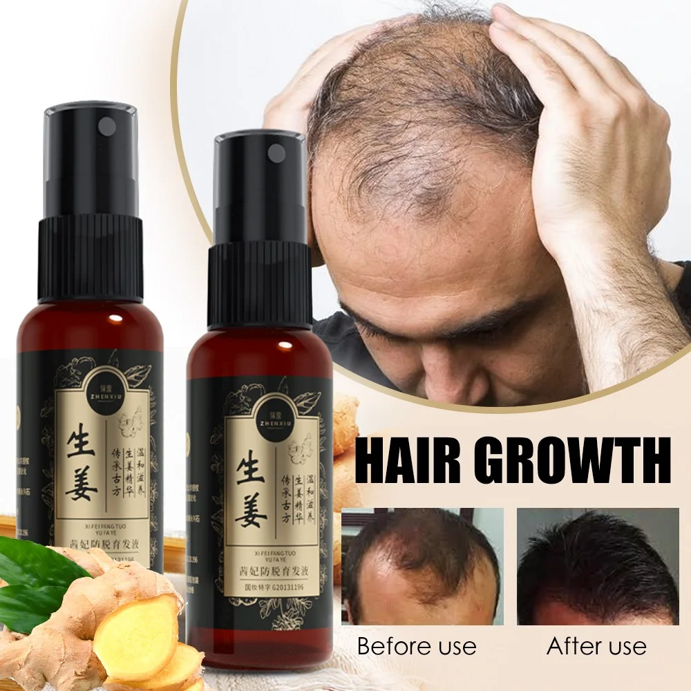 Ginger Fast Hair Growth Spray Natural  Anti Hair Loss Nourish Product Prevent Thinning Repair Damaged Hair Roots Men/Women