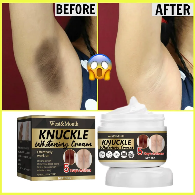 

Underarm Whitening Cream Bleach Body Legs Knee Elbow Armpit Lotion Improve Dull Remove Private Parts Dark Spots Melanin Brighten