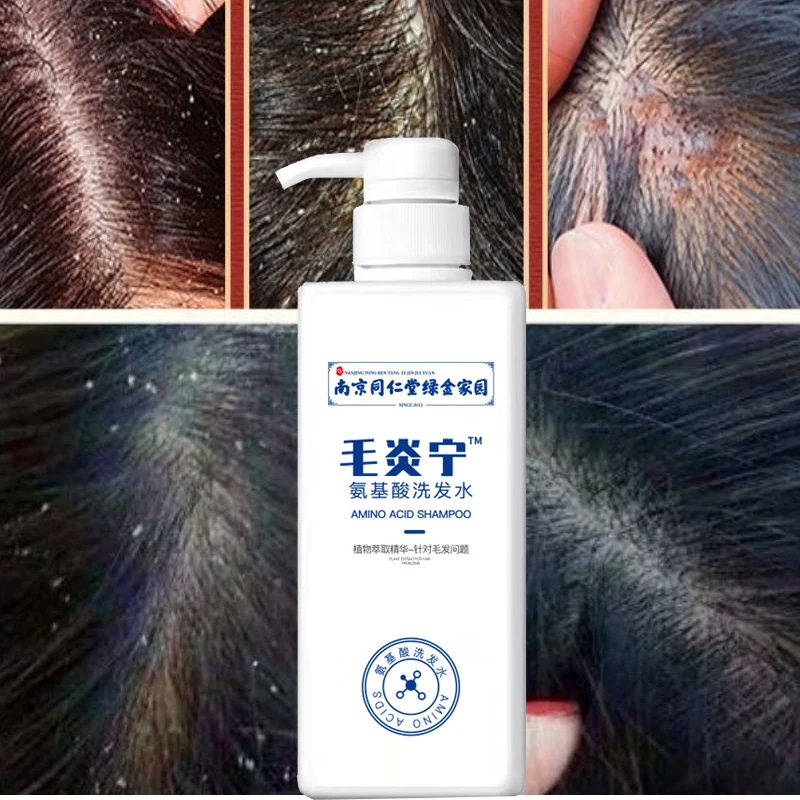 

500ml Hair Inflammation Shampoo Cleaning Scalp Hair Follicle Amino Acid Shampoo To Remove Mites Relieve Itching Nourish Scalp