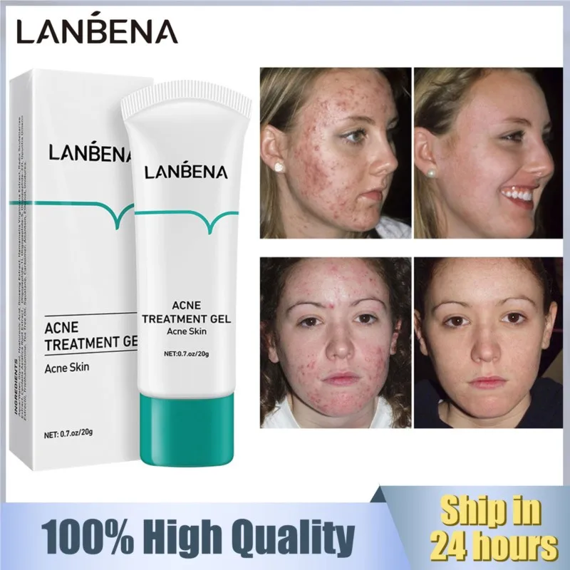 

LANBENA Acne Treatment Gel Anti Acne Face Cream Scar Pimple Removal Oil Control Fading Acne Marks Scars Repair Nourish SkinCare