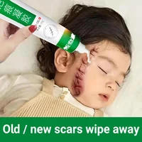 acne surgical scar removal gel cream pimples stretch marks acne spots burn surgical pigmentation treatment smooth face body skin