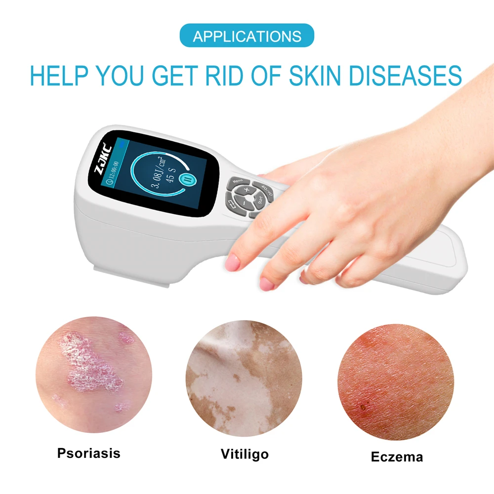 ZJKC 308 нм кожных заболеваний UVB светотерапия руки ноги фототерапевтический